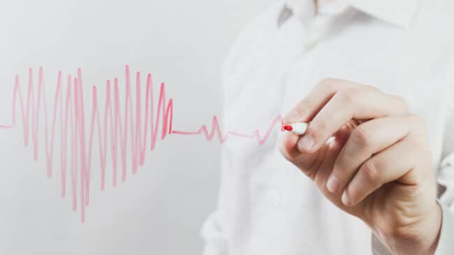 Ruhe EKG
